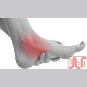 اسکن کف پا در غرب تهران